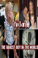 Watch Aidan The Rarest Boy In The World Movie25