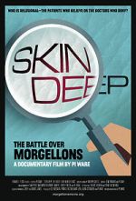 Watch Skin Deep: The Battle Over Morgellons Movie25