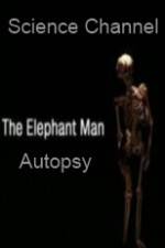 Watch Science Channel Elephant Man Autopsy Movie25