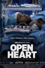 Watch Open Heart Movie25