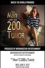 Watch The Man With The 200lb Tumor Movie25