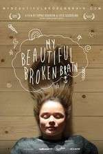 Watch My Beautiful Broken Brain Movie25