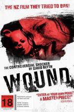 Watch Wound Movie25