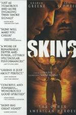 Watch Skins Movie25