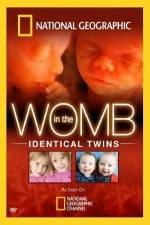 Watch National Geographic: In the Womb - Identical Twins Movie25