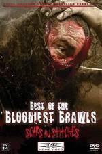 Watch TNA Wrestling: Best of the Bloodiest Brawls - Scars and Stitches Movie25