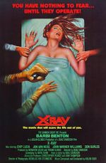 Watch X-Ray Movie25