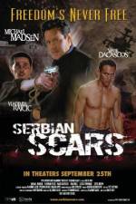 Watch Serbian Scars Movie25