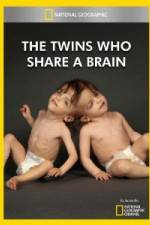 Watch National Geographic The Twins Who Share A Brain Movie25