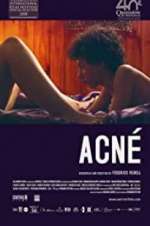 Watch Acné Movie25