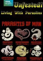 Watch Infested! Living with Parasites Movie25